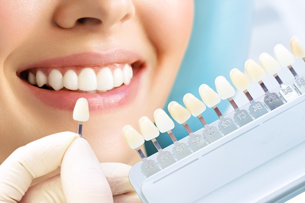 How Dental Veneers Can Transform More Than The Color Of Your Teeth